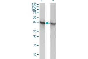 Western Blot analysis of ALDOA expression in transfected 293T cell line by ALDOA monoclonal antibody (M02), clone 3C12-6D11. (ALDOA antibody  (AA 1-364))