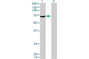 Western Blot analysis of MYLK2 expression in transfected 293T cell line by MYLK2 monoclonal antibody (M01), clone 2G1. (MYLK2 antibody  (AA 161-260))