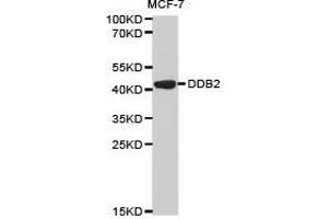 Western Blotting (WB) image for anti-Damage-Specific DNA Binding Protein 2, 48kDa (DDB2) antibody (ABIN1872225) (DDB2 antibody)