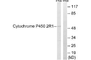Immunohistochemistry analysis of paraffin-embedded human colon carcinoma tissue using Cytochrome P450 2R1 antibody. (CYP2R1 antibody)