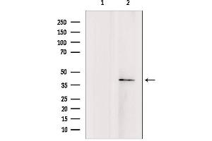 Western blot analysis of extracts from rat brain, using TMOD4 antibody. (Tropomodulin 4 antibody  (Internal Region))