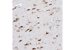 Immunohistochemical staining (Formalin-fixed paraffin-embedded sections) of human cerebral cortex with RRAGB polyclonal antibody  shows strong cytoplasmic positivity in neuronal cells. (RRAGA antibody)