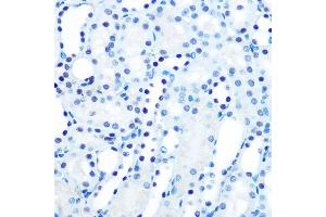 Immunohistochemistry of paraffin-embedded mouse kidney using M/M/ML1 Rabbit mAb (ABIN7268354) at dilution of 1:100 (40x lens). (MAD2L1 antibody)