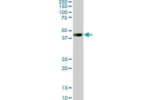 SMAD7 monoclonal antibody (M06), clone 4E1. (SMAD7 antibody  (AA 160-260))