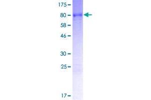 MEX3C Protein (AA 1-464) (GST tag)