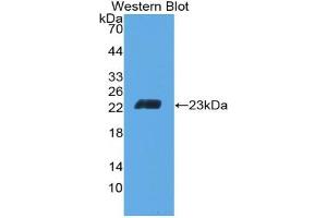 Detection of Recombinant CD6, Mouse using Polyclonal Antibody to Cluster Of Differentiation 6 (CD6) (CD6 antibody  (AA 30-204))