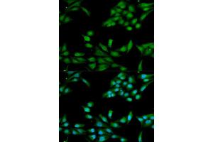 Immunofluorescence analysis of HeLa cell using MSH2 antibody. (MSH2 antibody  (AA 1-300))