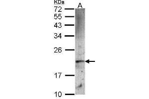 WB Image Sample (30 ug of whole cell lysate) A: A549 12% SDS PAGE antibody diluted at 1:1000 (FTH1 antibody  (Center))