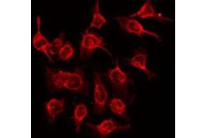 ABIN6275405 staining Hela by IF/ICC. (NDRG3 antibody  (Internal Region))