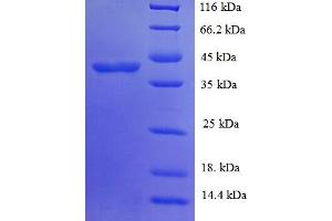 SDS-PAGE (SDS) image for Glycosyltransferase 8 Domain Containing 2 (GLT8D2) (AA 25-349) protein (His tag) (ABIN5709591)