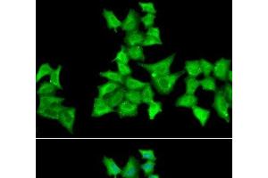 Immunofluorescence analysis of A549 cells using HAPLN1 Polyclonal Antibody (HAPLN1 antibody)
