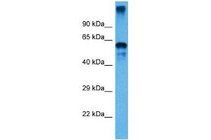 Host:  Mouse  Target Name:  P4HB  Sample Tissue:  Mouse Small Intestine  Antibody Dilution:  1ug/ml (P4HB antibody  (C-Term))