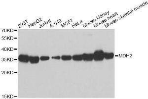 Western blot analysis of extracts of various cell lines, using MDH2 antibody. (MDH2 antibody  (AA 59-338))