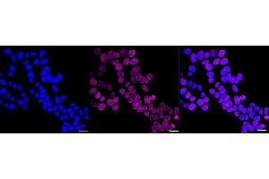 anti-Lamin B Receptor (LBR) antibody