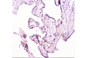 IHC analysis of TANK using anti-TANK antibody (ABIN6719508). (TANK antibody)