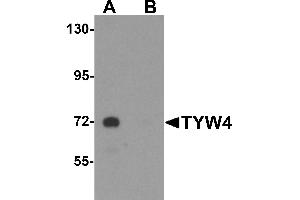Western blot analysis of TYW4 in rat brain tissue lysate with TYW4 antibody at 1 µg/mL in (A) the absence and (B) the presence of blocking peptide. (LCMT2 antibody  (N-Term))
