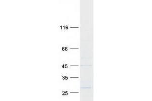 Validation with Western Blot