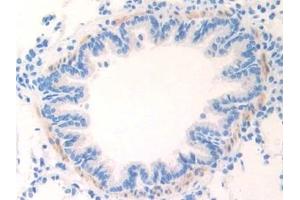 Immunohistochemistry (IHC) image for anti-Cardiac Troponin I (TNNI3) (AA 1-211) antibody (ABIN7431863)