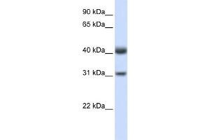 WB Suggested Anti-PDSS2 Antibody Titration:  0.