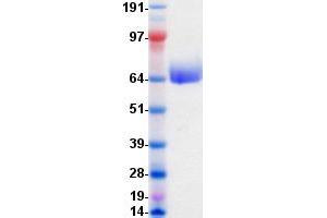 Western Blotting (WB) image for EPH Receptor A5 (EPHA5) protein (DYKDDDDK-His Tag) (ABIN2720239)