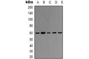 Western blot analysis of TRAF6 expression in Hela (A), K562 (B), Rat kidney (C), Rat heart (D), mouse kidney (E) whole cell lysates. (TRAF6 antibody)