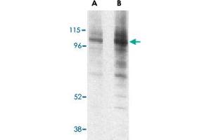 Western blot analysis of LAMP1 in EL4 cell lysate with LAMP1 polyclonal antibody  at (A) 1 and (B) 2 ug/mL . (LAMP1 antibody  (Internal Region))