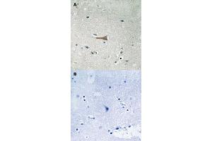 Immunohistochemical staining of human brain tissue by DDR1 (phospho Y513) polyclonal antibody  without blocking peptide (A) or preincubated with blocking peptide (B) under 1:50-1:100 dilution.