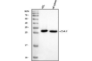 Western blot analysis of Carbonic Anhydrase I/CA1 using anti-Carbonic Anhydrase I/CA1 antibody (ABIN3042694).
