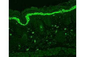 Immunohistochemistry analysis using Mouse Anti-Phosphotyrosine Monoclonal Antibody, Clone G104 . (Phosphotyrosine antibody  (FITC))