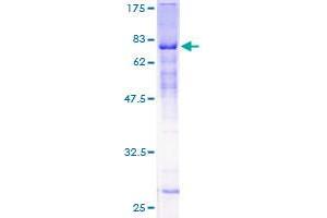 Image no. 1 for Zinc Finger Protein 19 (ZNF19) (AA 1-458) protein (GST tag) (ABIN1325951) (ZNF19 Protein (AA 1-458) (GST tag))