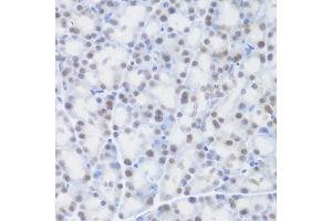 Immunohistochemistry of paraffin-embedded rat pancreas using MCM4 Antibody (ABIN5971548) at dilution of 1/100 (40x lens). (MCM4 antibody)