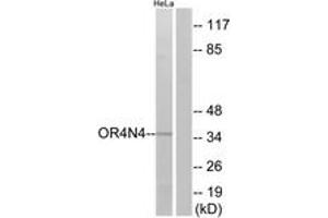 Western blot analysis of extracts from HeLa cells, using OR4N4 Antibody.
