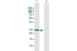 Western Blot analysis of SSPN expression in transfected 293T cell line by SSPN MaxPab polyclonal antibody.