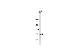 Anti-SYK Antibody  at 1:1000 dilution + Raji whole cell lysate Lysates/proteins at 20 μg per lane. (SYK antibody  (C-Term))