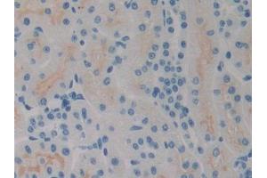 DAB staining on IHC-P; Samples: Rat Kidney Tissue (SPRY2 antibody  (AA 116-304))
