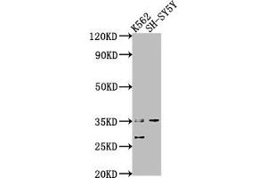 Western Blot Positive WB detected in: K562 whole cell lysate, SH-SY5Y whole cell lysate All lanes: THOC6 antibody at 1:2000 Secondary Goat polyclonal to rabbit IgG at 1/50000 dilution Predicted band size: 38, 35, 33 kDa Observed band size: 35 kDa (THOC6 antibody  (AA 56-315))