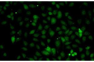Immunofluorescence analysis of A-549 cells using C1S Polyclonal Antibody (C1S antibody)