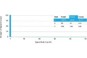 Analysis of Protein Array containing more than 19,000 full-length human proteins using PAPP-A Mouse Monoclonal Antibody (PAPPA/2715) Z- and S- Score: The Z-score represents the strength of a signal that a monoclonal antibody (MAb) (in combination with a fluorescently-tagged anti-IgG secondary antibody) produces when binding to a particular protein on the HuProtTM array. (PAPPA antibody  (AA 351-523))