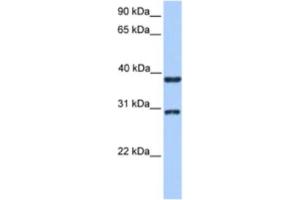 Western Blotting (WB) image for anti-Kelch Domain Containing 1 (KLHDC1) antibody (ABIN2463544) (KLHDC1 antibody)