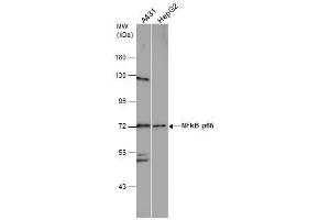 WB Image Various whole cell extracts (30 μg) were separated by 7. (NF-kB p65 antibody  (Center))