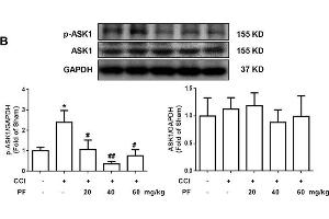Paeoniflorin mimicked ASK1 inhibitor and decreased the phosphorylation of ASK1 in vivo. (ASK1 antibody  (pThr845))
