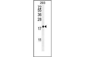 Western blot analysis of PCOTH Antibody (Center) in 293 cell line lysates (35ug/lane). (PCOTH antibody  (Middle Region))