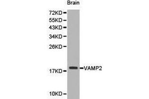 Western Blotting (WB) image for anti-Vesicle-Associated Membrane Protein 2 (Synaptobrevin 2) (VAMP2) antibody (ABIN1875306) (VAMP2 antibody)