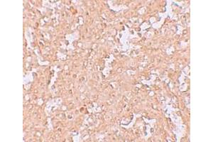 Immunohistochemistry (IHC) image for anti-Zinc Finger and BTB Domain Containing 8A (ZBTB8A) (C-Term) antibody (ABIN1030814) (ZBTB8A antibody  (C-Term))