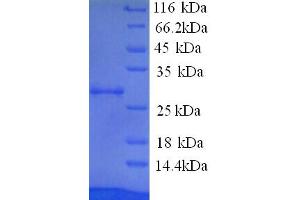 SDS-PAGE (SDS) image for Paraneoplastic Antigen MA2 (PNMA2) (AA 2-263), (partial) protein (His tag) (ABIN5713746) (PNMA2 Protein (AA 2-263, partial) (His tag))