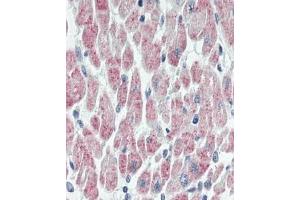 Immunhistochemistry analysis in human heart tissue (Formalin-fixed, Paraffin-embedded) using USP19  (USP19 antibody  (Internal Region))