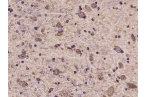 Paraformaldehyde-fixed, paraffin embedded rat brain Antigen retrieval by boiling in sodium citrate buffer (pH6. (TYK2 antibody  (pTyr1054, pTyr1055))
