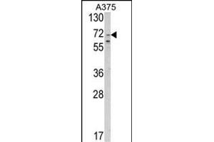 Western blot analysis of SLC23A2 Antibody (N-term) (ABIN652594 and ABIN2842398) in  cell line lysates (35 μg/lane). (SLC23A2 antibody  (N-Term))