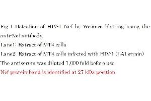 Western Blotting (WB) image for anti-HIV-1 Nef (full length) antibody (ABIN2452025) (HIV-1 Nef (full length) antibody)