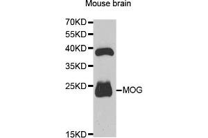 Western Blotting (WB) image for anti-Myelin Oligodendrocyte Glycoprotein (MOG) antibody (ABIN1876541) (MOG antibody)